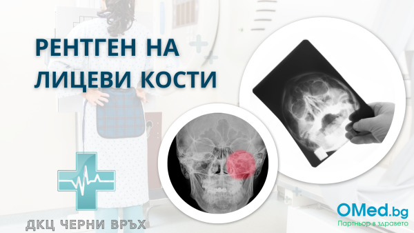 Рентген на лицеви кости от ДКЦ Черни връх