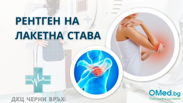 Рентген на лакетна става от ДКЦ Черни връх